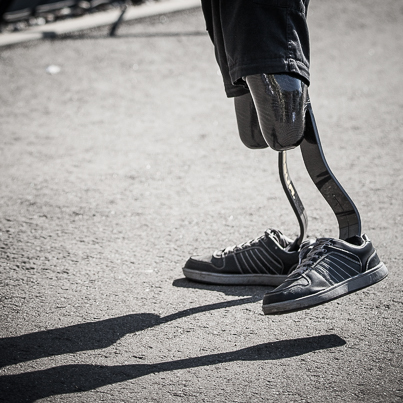 Prothesen in Bewegung